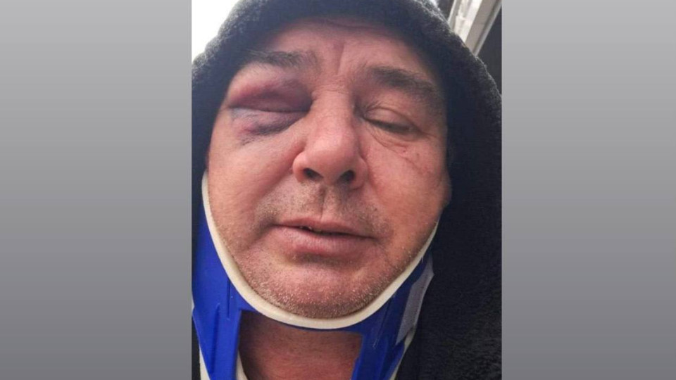 На Київщині працівники ТЦК побили водія на очах у поліції, відео