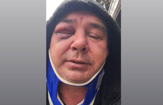 На Киевщине работники ТЦК избили водителя на глазах у полиции, видео