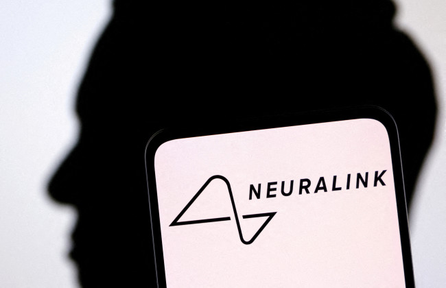 Компанія Ілона Маска Neuralink показала, як її пацієнт зміг переміщувати курсор силою думки, відео